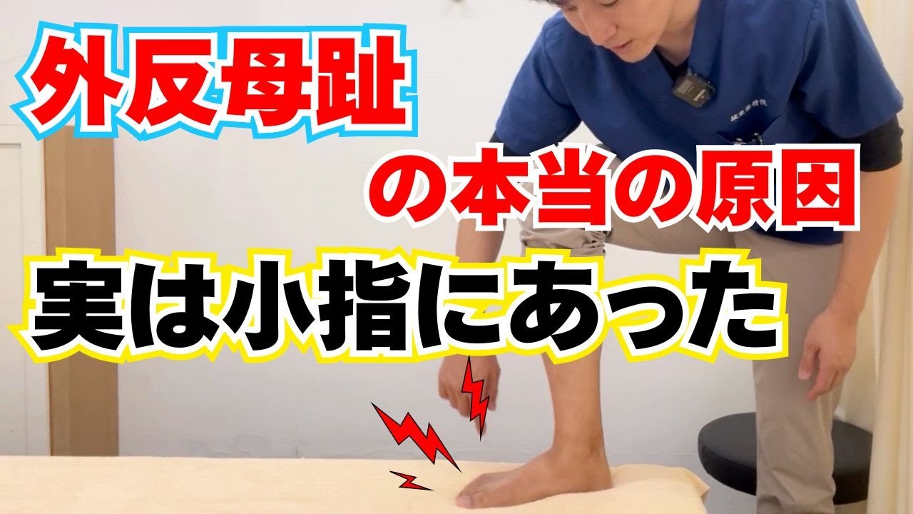 小指が曲がっていると外反母趾が悪化する？内反小趾を防ぐ足裏セルフケア
