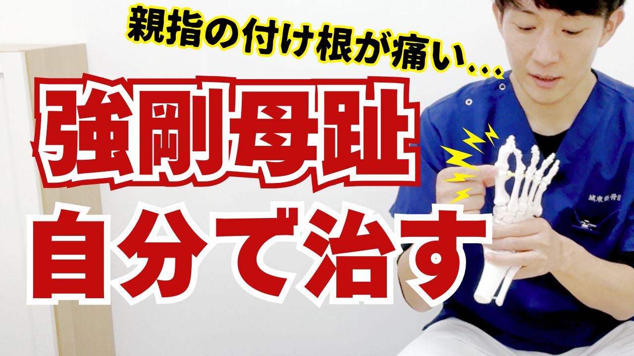 外反母趾と間違えやすい「強剛母趾」とは？自宅でできる2つのセルフケア